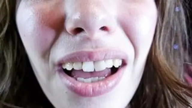 MOUTH CLOSE UP
