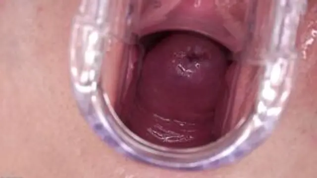 Opening Seen